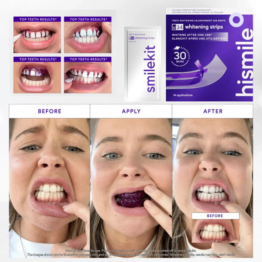 Benzi de albire avansate cu dublă acțiune SmileKit™